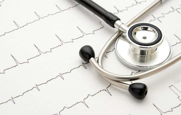 EKG