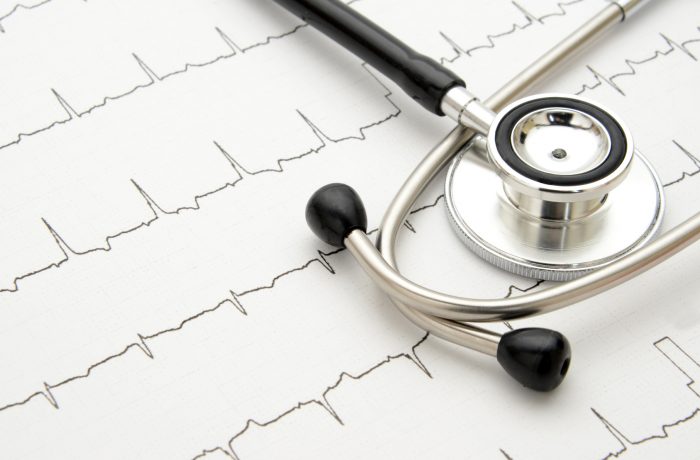 EKG