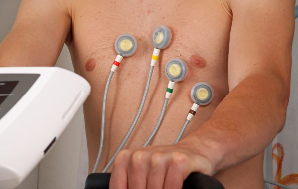 Ergometrie (Belastungs-EKG)